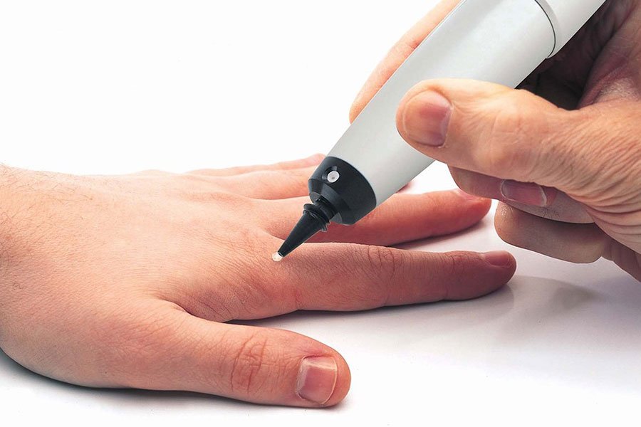 CryoProbe