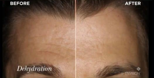 Environ Ionzyme DF Before and After