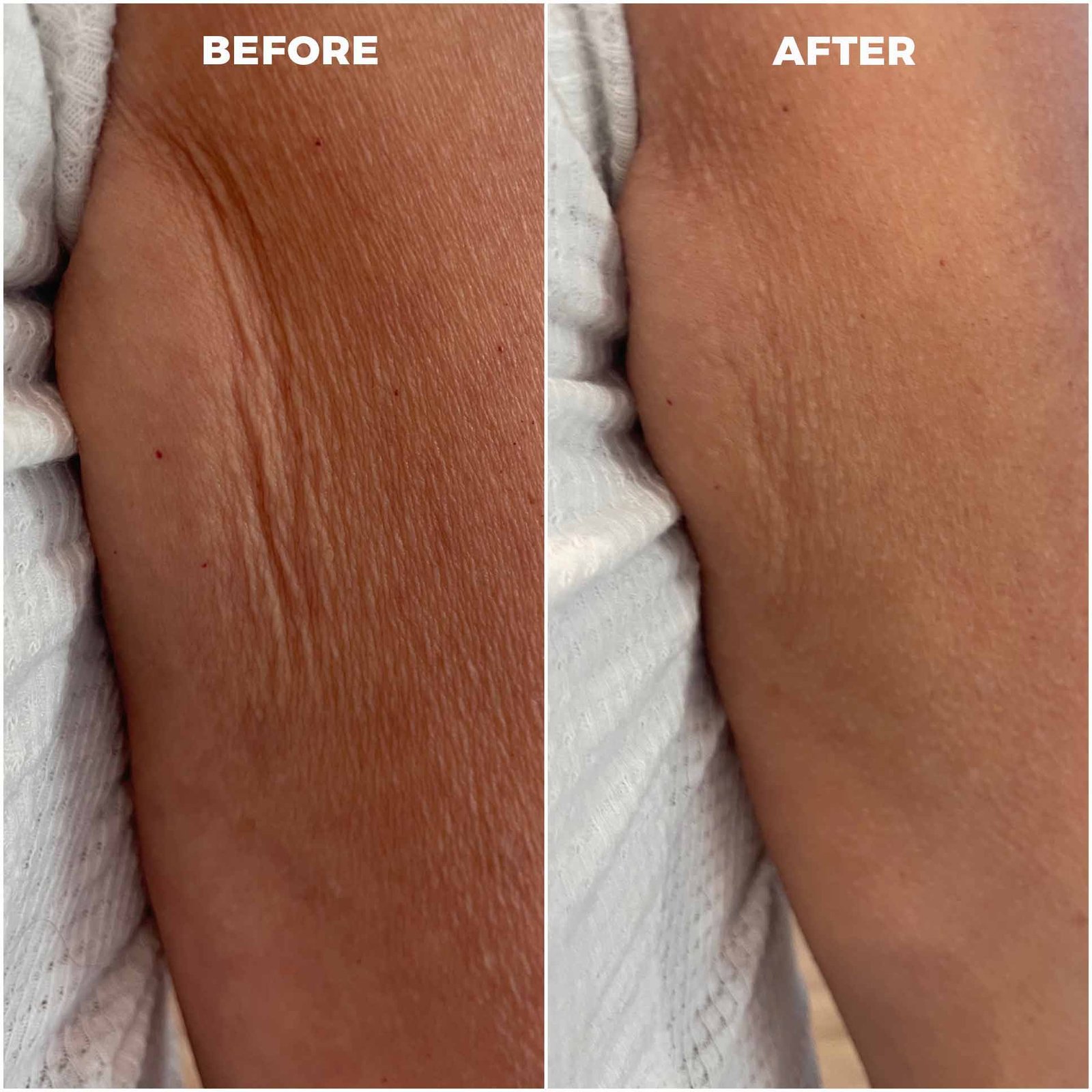 Environ Ionzyme DF Before and After